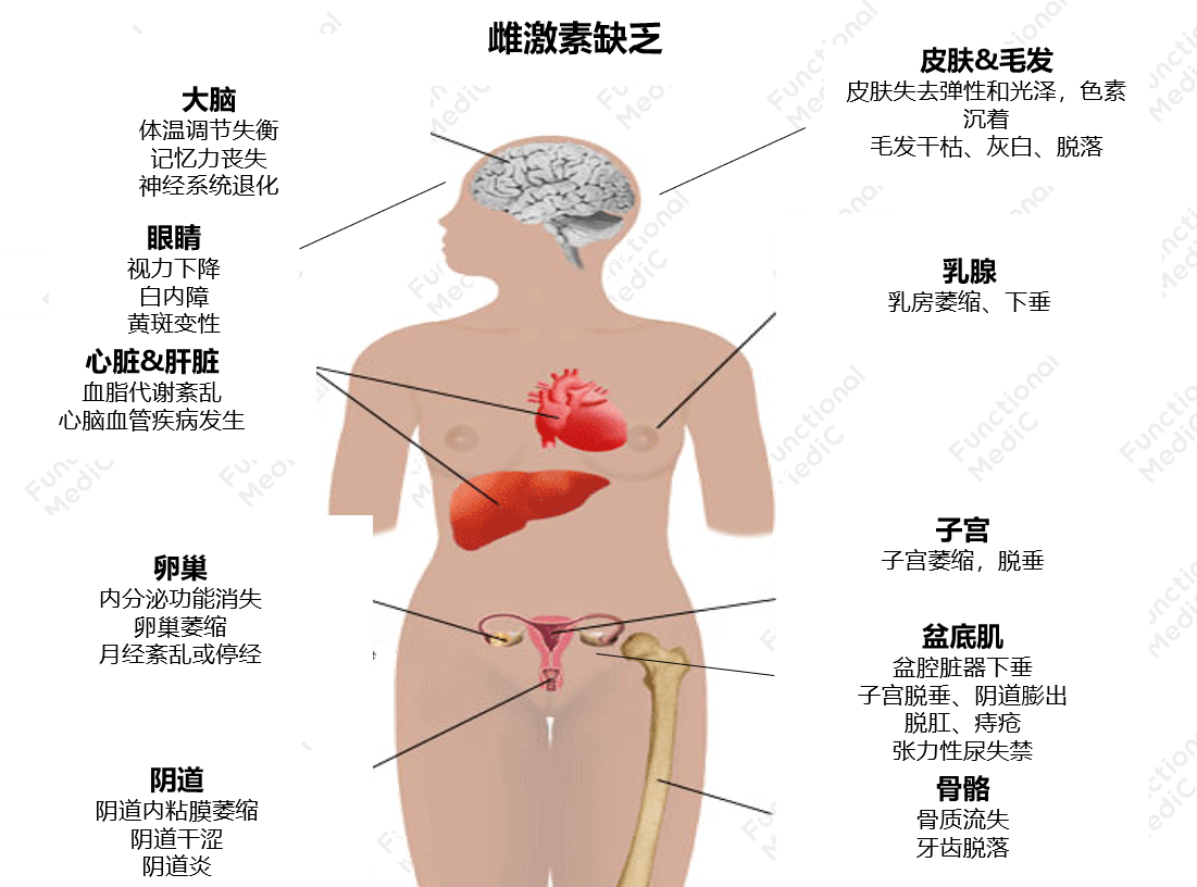 温故而知新专栏 | 雌激素代谢失衡的功能医学干预（上）